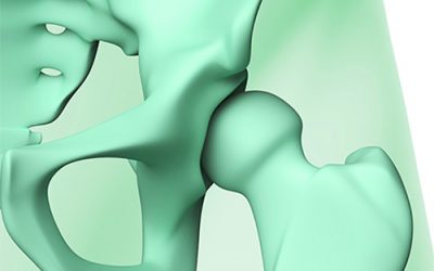 La Mésothérapie Articulaire