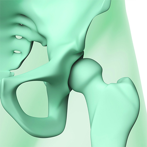 La Mésothérapie Articulaire